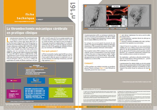 La lettre du neurologue - Fiche technique - Thrombectomie mécanique cérébrale